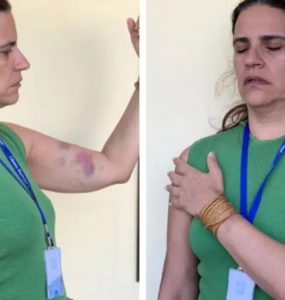 Jornalista acusa de agressão ex-chefe da TV Câmara de Natal