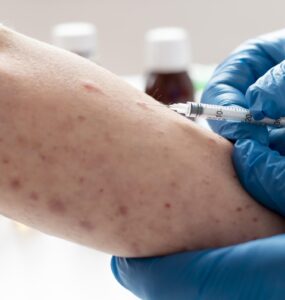 Nova variante da mpox é mais letal, diz infectologista