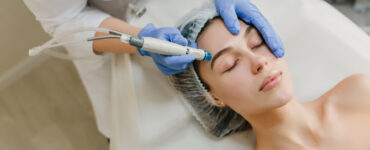 Tratamentos para melasma evoluíram no Brasil, diz médica