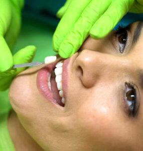 Facetas dentárias possibilitam um sorriso mais alinhado