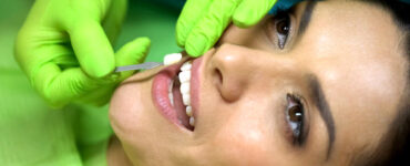 Facetas dentárias possibilitam um sorriso mais alinhado