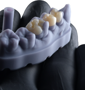 FGM Dental Group e dOne 3D apresentam a Voxelprint Ceramic