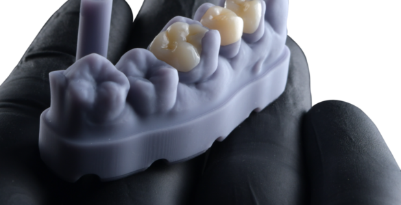 FGM Dental Group e dOne 3D apresentam a Voxelprint Ceramic