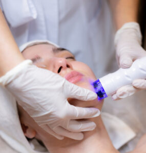 Tecnologia a laser aprimora tratamentos dermatológicos