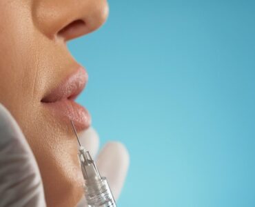 Técnica Safe Lips reduz riscos no preenchimento labial