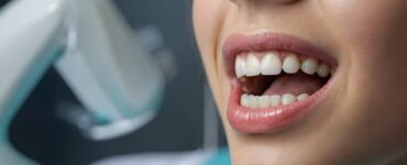 Clareamento dental com PAP reduz a sensibilidade e irritação