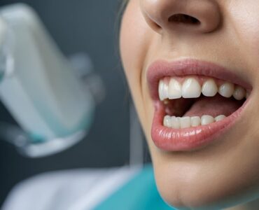 Clareamento dental com PAP reduz a sensibilidade e irritação