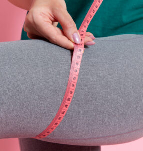 Em média, 5 milhões de brasileiras têm lipedema e não sabem