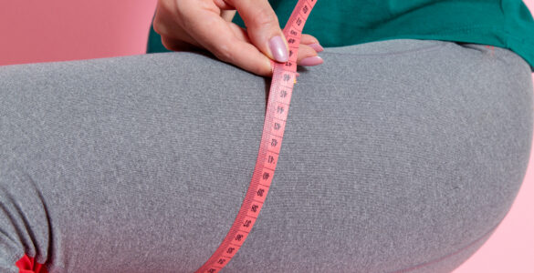 Em média, 5 milhões de brasileiras têm lipedema e não sabem
