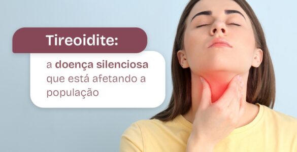 Tireoidite: doença silenciosa vem afetando a população