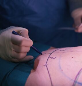 Tecnologia otimiza resultados em cirurgias plásticas