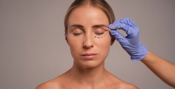 Blefaroplastia é o 3º procedimento mais realizado em 2023
