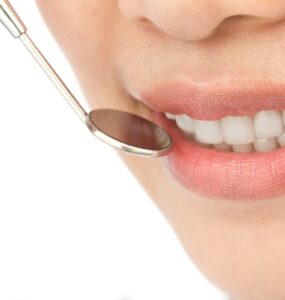 Exagerar no clareamento pode prejudicar os dentes