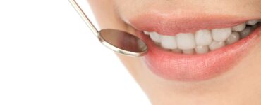 Exagerar no clareamento pode prejudicar os dentes