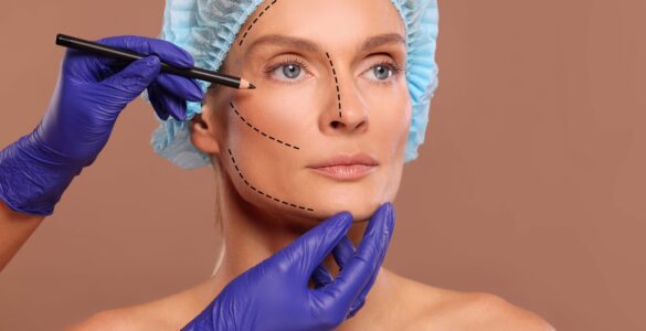 Rejuvenescimento facial deve buscar naturalidade, diz médico