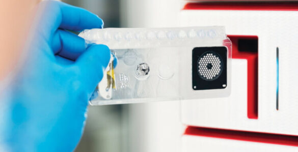 ANS inclui teste para meningite e encefalite no rol