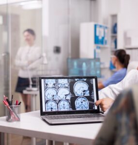Inovações no tratamento de AVC transformam saúde no Brasil