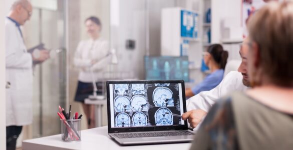 Inovações no tratamento de AVC transformam saúde no Brasil