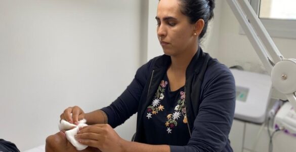 Harmonização facial sem exageros realça a beleza natural