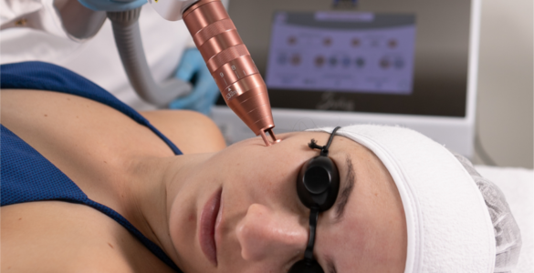 IBRAMED lança novas tecnologias para estética e reabilitação