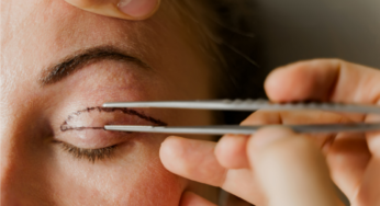 Blefaroplastia: procedimento que rejuvenesce o olhar
