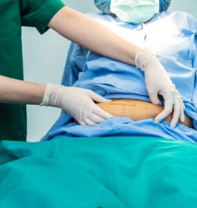 Bariátrica por videolaparoscopia permite melhor recuperação