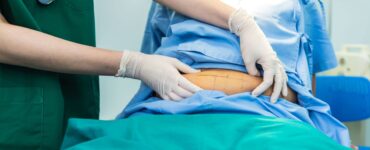 Bariátrica por videolaparoscopia permite melhor recuperação