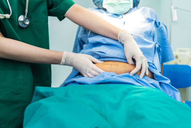 Bariátrica por videolaparoscopia permite melhor recuperação