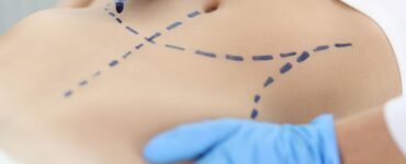 Cirurgia plástica: busca por resultados naturais é tendência
