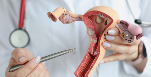 Tumores ginecológicos afetam 13% das mulheres no Brasil