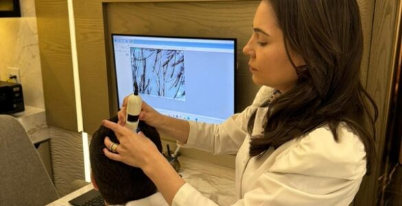 Busca por transplante capilar deve elevar 9% ao ano até 2029