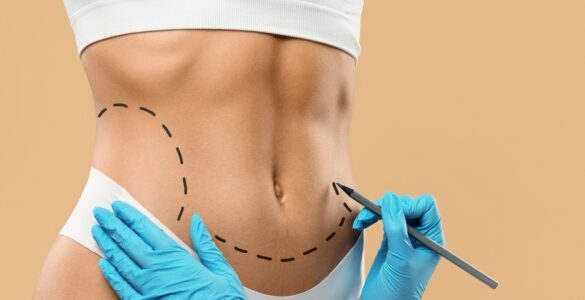 Beleza natural é foco da cirurgia plástica em 2025
