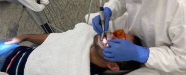 Tecnologia permite clareamento dental com facetas em um dia