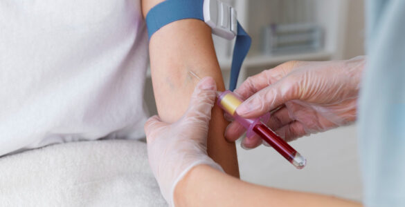 Diagnóstico rápido favorece cura da leucemia, afirma médico
