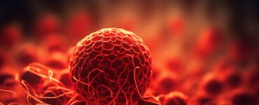 Car-T Cell é esperança para pacientes com mieloma múltiplo