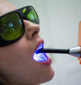 Técnicas com laser avançam em tratamentos odontológicos