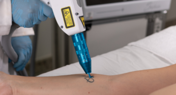 Procura por remoção de tatuagens cresce no Brasil