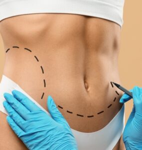 Cirurgia plástica busca naturalidade e equilíbrio