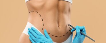 Cirurgia plástica busca naturalidade e equilíbrio
