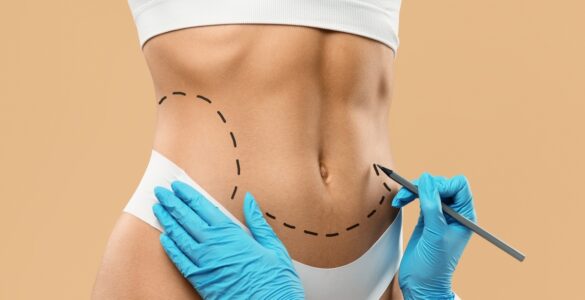 Cirurgia plástica busca naturalidade e equilíbrio