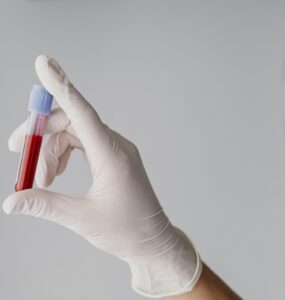 Transplante de medula óssea possibilita cura de 80 doenças