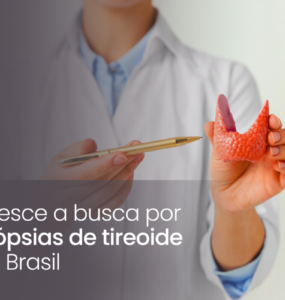 Cresce a busca por biópsias de tireoide no Brasil