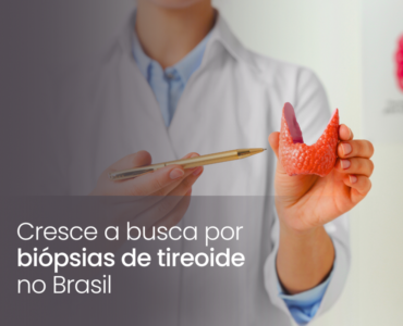 Cresce a busca por biópsias de tireoide no Brasil