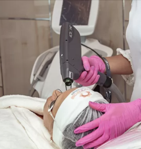 Dermatologista em Belém explica as causas e soluções para queda de cabelo