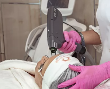 Dermatologista em Belém explica as causas e soluções para queda de cabelo
