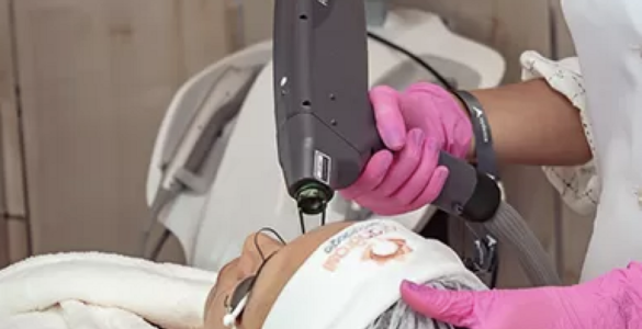 Dermatologista em Belém explica as causas e soluções para queda de cabelo