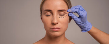 Cirurgia plástica ocular vai além da estética