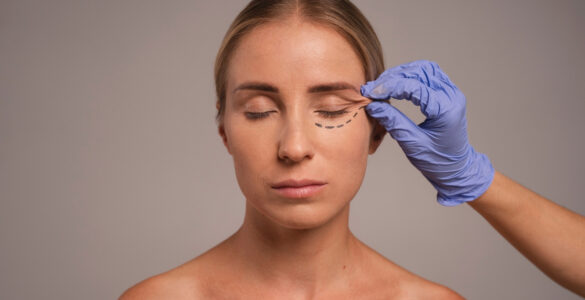 Cirurgia plástica ocular vai além da estética