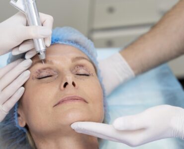 Rejuvenescimento facial alia diferentes técnicas