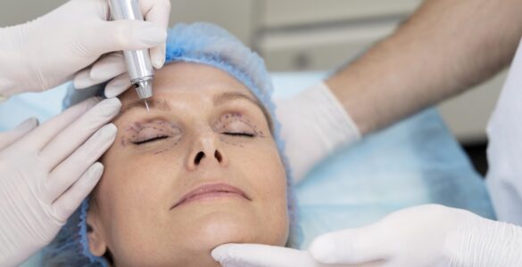 Rejuvenescimento facial alia diferentes técnicas